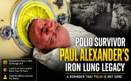 Polio Survivor Paul Alexander's Iron Lung Legacy Trends Again